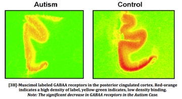 GABA Y AUTISMO