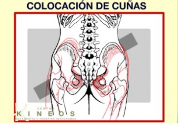 Curso Técnica Sacro Occipital, Sacro Occipital Technique (SOT) Bertrand DeJarnette 